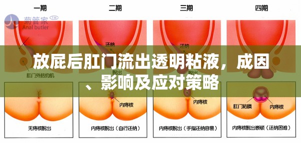 放屁后肛門(mén)流出透明粘液，成因、影響及應(yīng)對(duì)策略