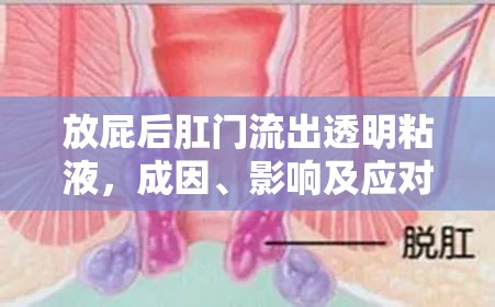 放屁后肛門(mén)流出透明粘液，成因、影響及應(yīng)對(duì)策略