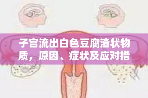 子宮流出白色豆腐渣狀物質(zhì)，原因、癥狀及應(yīng)對(duì)措施