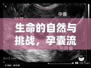 生命的自然與挑戰(zhàn)，孕囊流出的經(jīng)歷