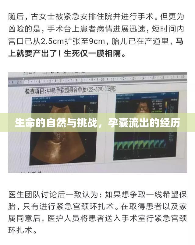 生命的自然與挑戰(zhàn)，孕囊流出的經(jīng)歷