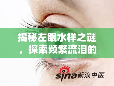 揭秘左眼水樣之謎，探索頻繁流淚的背后