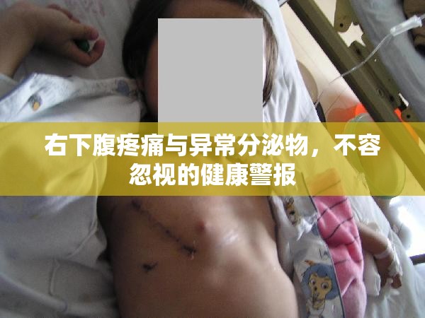 右下腹疼痛與異常分泌物，不容忽視的健康警報