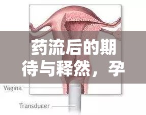 藥流后的期待與釋然，孕囊排出的時(shí)間與注意事項(xiàng)