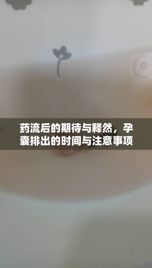 藥流后的期待與釋然，孕囊排出的時(shí)間與注意事項(xiàng)