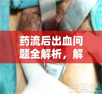 藥流后出血問題全解析，解答你對藥流后流血的疑問