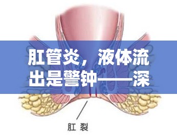 肛管炎，液體流出是警鐘——深入解析癥狀與應對策略