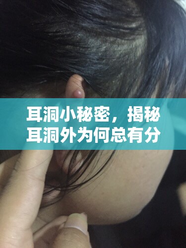 耳洞小秘密，揭秘耳洞外為何總有分泌物流出