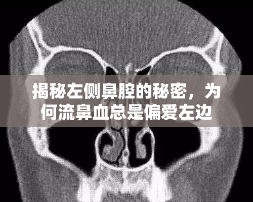揭秘左側(cè)鼻腔的秘密，為何流鼻血總是偏愛左邊