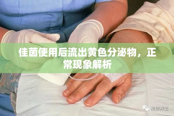 佳茵使用后流出黃色分泌物，正?，F(xiàn)象解析