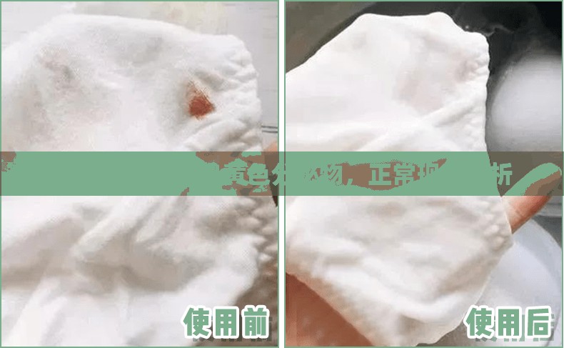 佳茵使用后流出黃色分泌物，正?，F(xiàn)象解析
