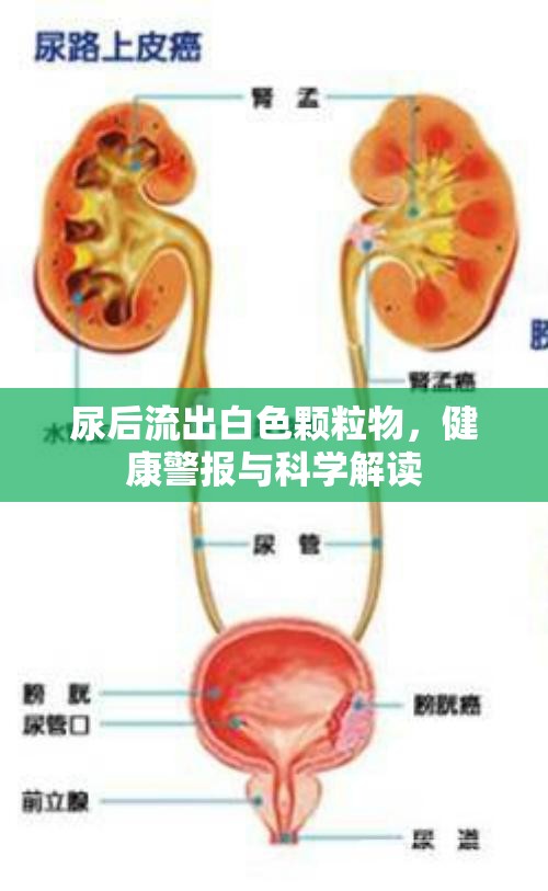 尿后流出白色顆粒物，健康警報(bào)與科學(xué)解讀