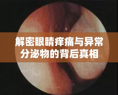 解密眼睛癢痛與異常分泌物的背后真相