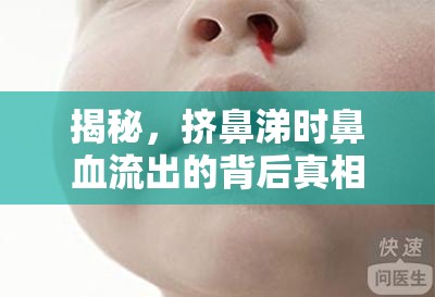 揭秘，擠鼻涕時(shí)鼻血流出的背后真相