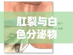 肛裂與白色分泌物，深入解析與應(yīng)對(duì)策略