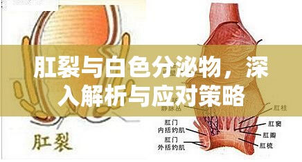 肛裂與白色分泌物，深入解析與應(yīng)對(duì)策略