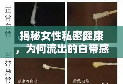 揭秘女性私密健康，為何流出的白帶感覺涼颼颼？