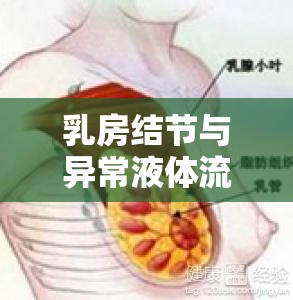 乳房結(jié)節(jié)與異常液體流出，了解癥狀，及早應(yīng)對(duì)