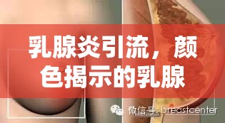 乳腺炎引流，顏色揭示的乳腺健康密碼