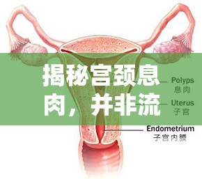 揭秘宮頸息肉，并非流出物，實為宮頸上的小肉芽