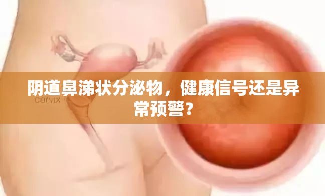 陰道鼻涕狀分泌物，健康信號還是異常預警？