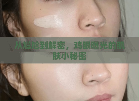 從尷尬到解密，雞眼曝光的肌膚小秘密