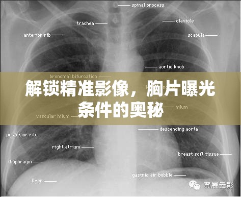 解鎖精準(zhǔn)影像，胸片曝光條件的奧秘