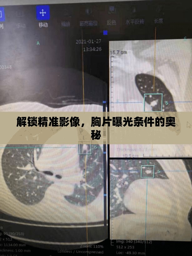 解鎖精準(zhǔn)影像，胸片曝光條件的奧秘
