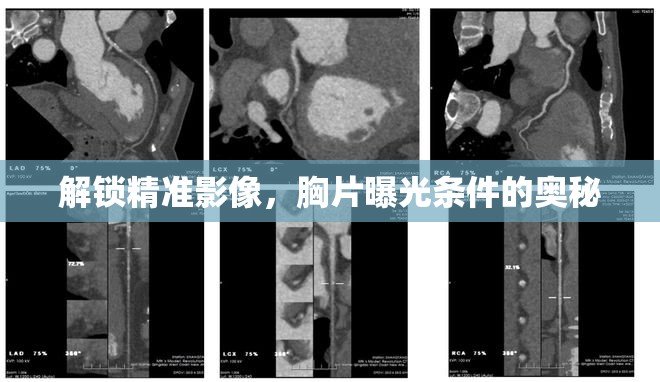 解鎖精準(zhǔn)影像，胸片曝光條件的奧秘