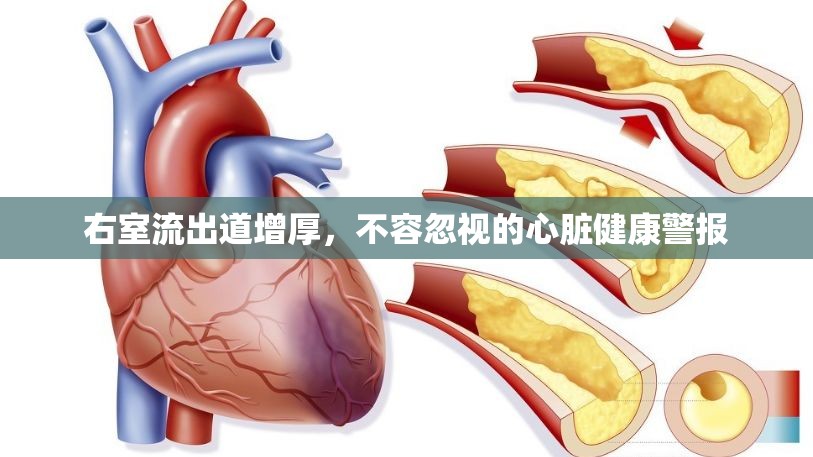 右室流出道增厚，不容忽視的心臟健康警報