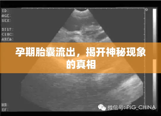 孕期胎囊流出，揭開神秘現(xiàn)象的真相