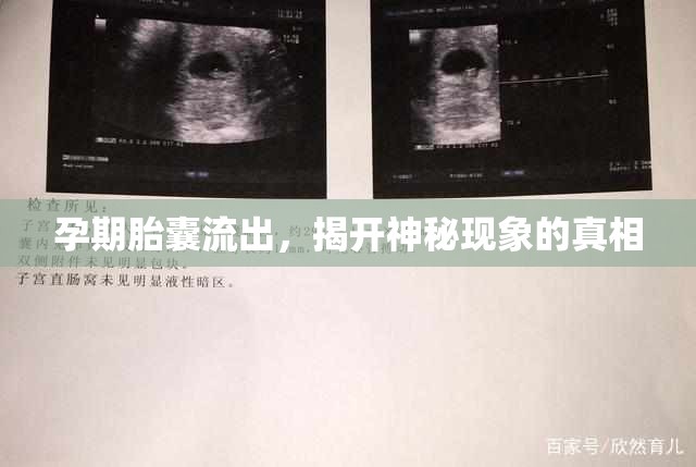 孕期胎囊流出，揭開神秘現(xiàn)象的真相