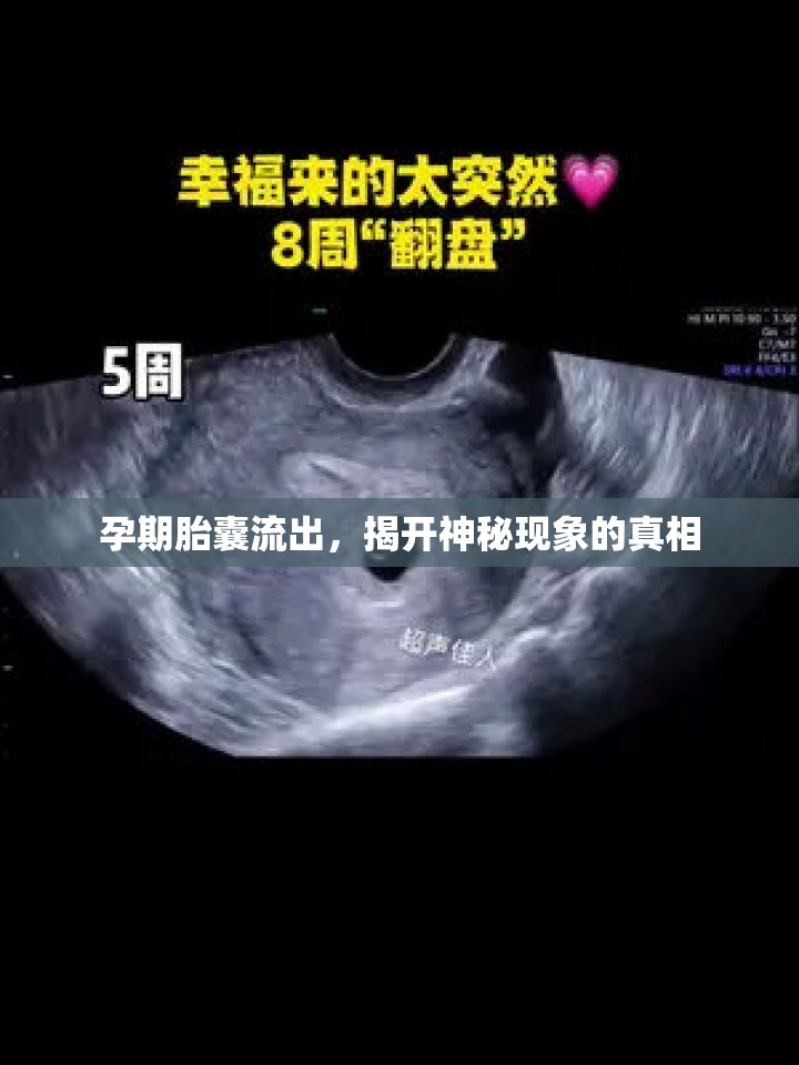 孕期胎囊流出，揭開神秘現(xiàn)象的真相