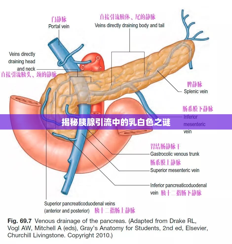 揭秘胰腺引流中的乳白色之謎