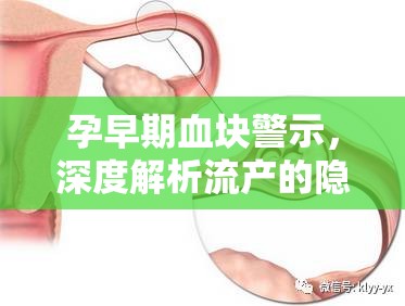 孕早期血塊警示，深度解析流產(chǎn)的隱秘信號