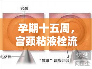 孕期十五周，宮頸粘液栓流出的奧秘與科學(xué)應(yīng)對策略