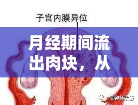 月經(jīng)期間流出肉塊，從生理現(xiàn)象到健康關(guān)懷的全面解析