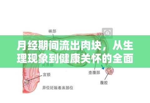 月經(jīng)期間流出肉塊，從生理現(xiàn)象到健康關(guān)懷的全面解析