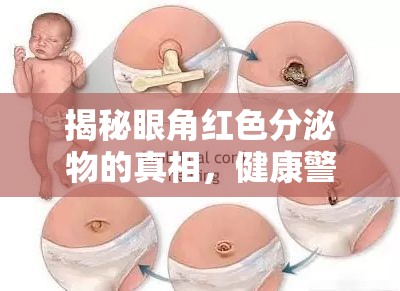 揭秘眼角紅色分泌物的真相，健康警報(bào)與日常護(hù)理指南