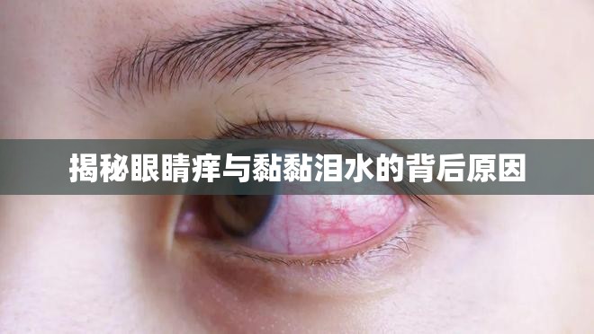 揭秘眼睛癢與黏黏淚水的背后原因