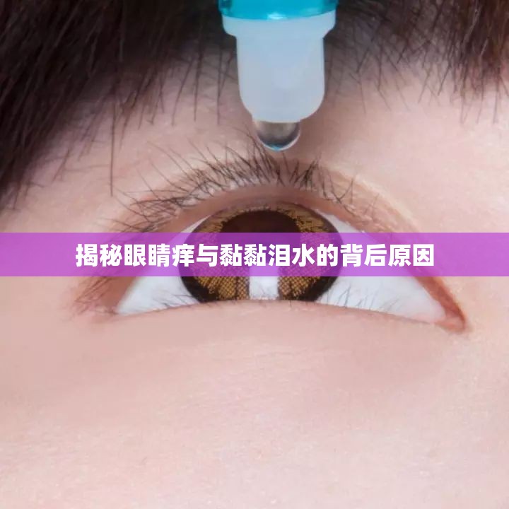 揭秘眼睛癢與黏黏淚水的背后原因