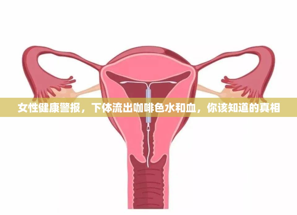 女性健康警報，下體流出咖啡色水和血，你該知道的真相