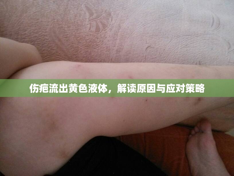 傷疤流出黃色液體，解讀原因與應(yīng)對策略
