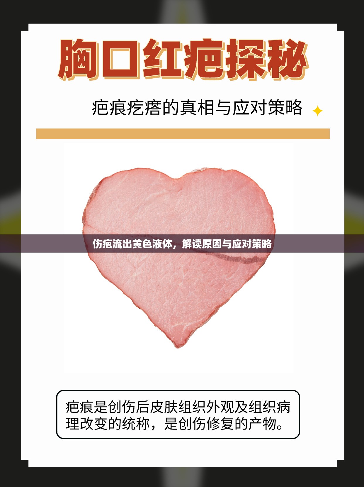 傷疤流出黃色液體，解讀原因與應(yīng)對策略
