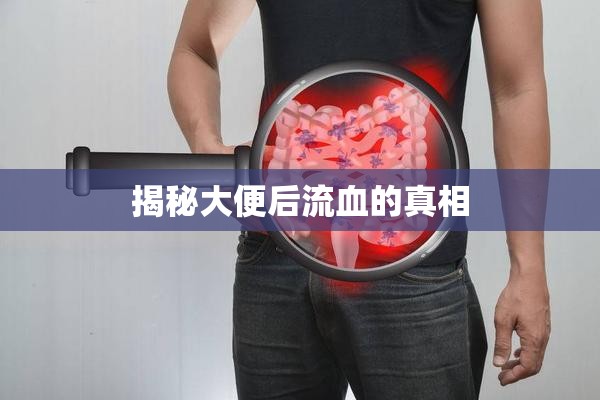 揭秘大便后流血的真相
