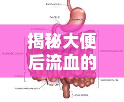 揭秘大便后流血的真相