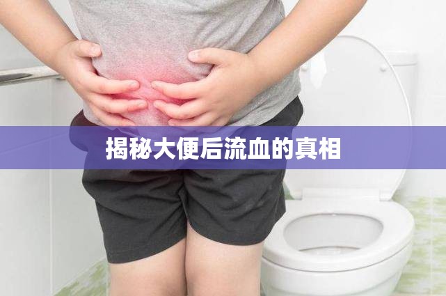揭秘大便后流血的真相