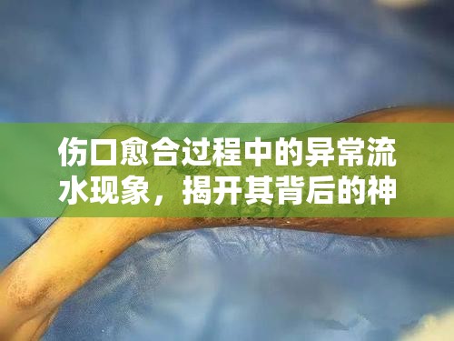 傷口愈合過程中的異常流水現(xiàn)象，揭開其背后的神秘面紗