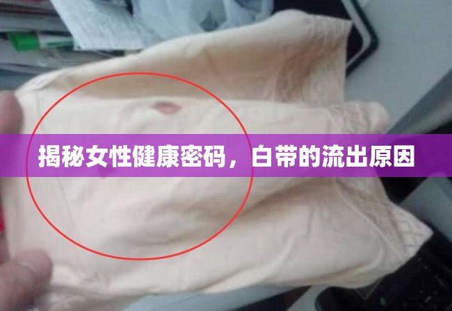 揭秘女性健康密碼，白帶的流出原因