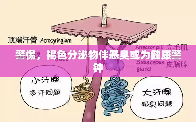 警惕，褐色分泌物伴惡臭或為健康警鐘